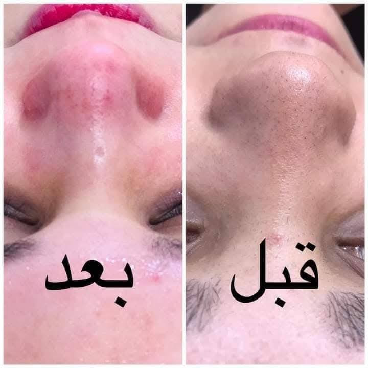 عنوان سكندريه طريق ياحسين على جسر الافته ويه نهر صالون ضل الياسمين هاذا رقم محل***********
