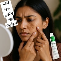 عصارة كلوفيت • علاج الكلف • خالي من الكورتيزون