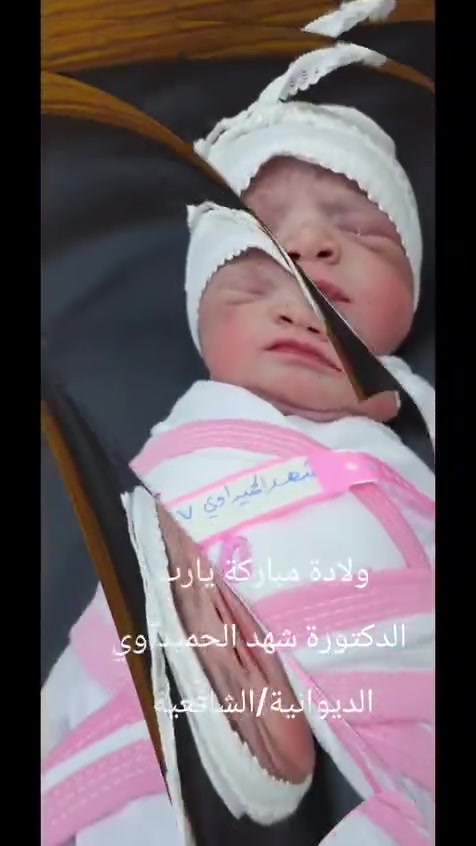الحمد لله على سلامة مريضتي العزيزة من أهالي الحمزة الكرام
ولادة مباركة بعد 
عقم أولي سنتين
نورت الدنيا هذه الجميلة 
ربي يحفظها لذويها ويجعلها قرة عين لهم 🌺
للحجز والاستفسار الاتصال على الأرقام 
***********

***********
