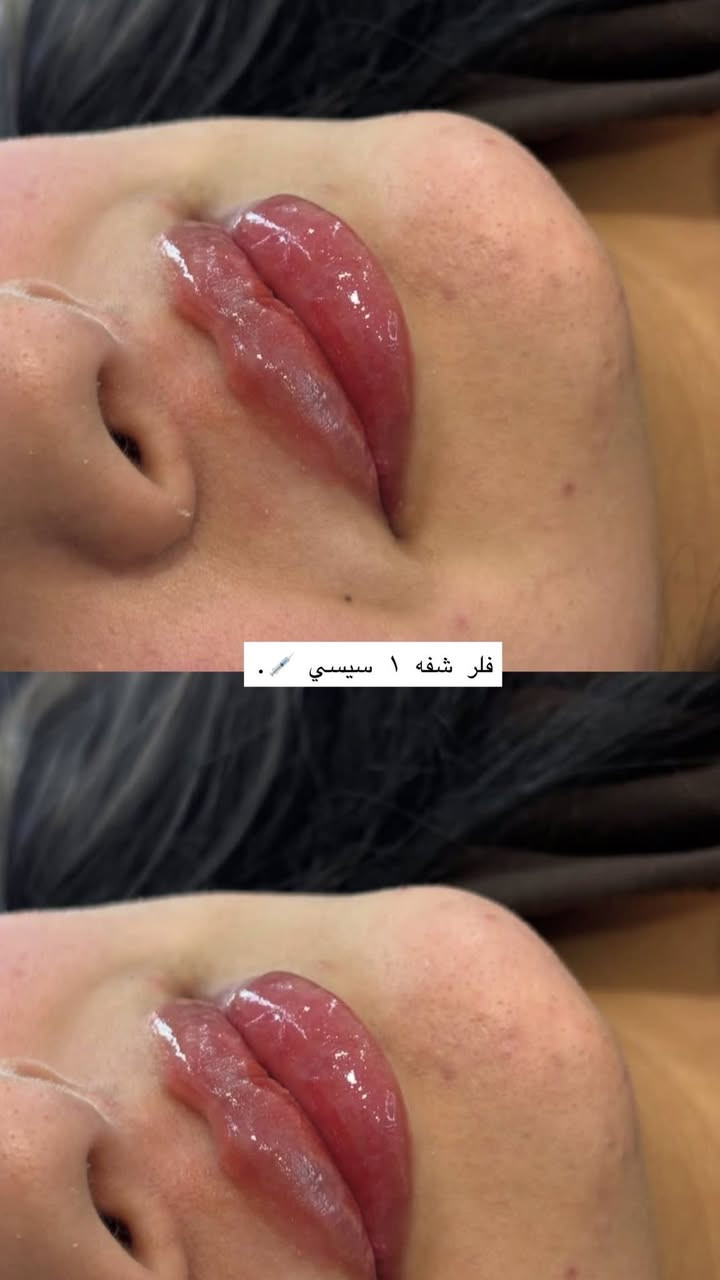 عروض العيد ويه صالون الجميلات الحريه الزراعي الشاكر العاني للاستفسار على الخاص


**إذا كنت صاحب هذا الإعلان وتريد حذفه لأي سبب، رجاءا أرسل رسالة إلى الدعم الفني**