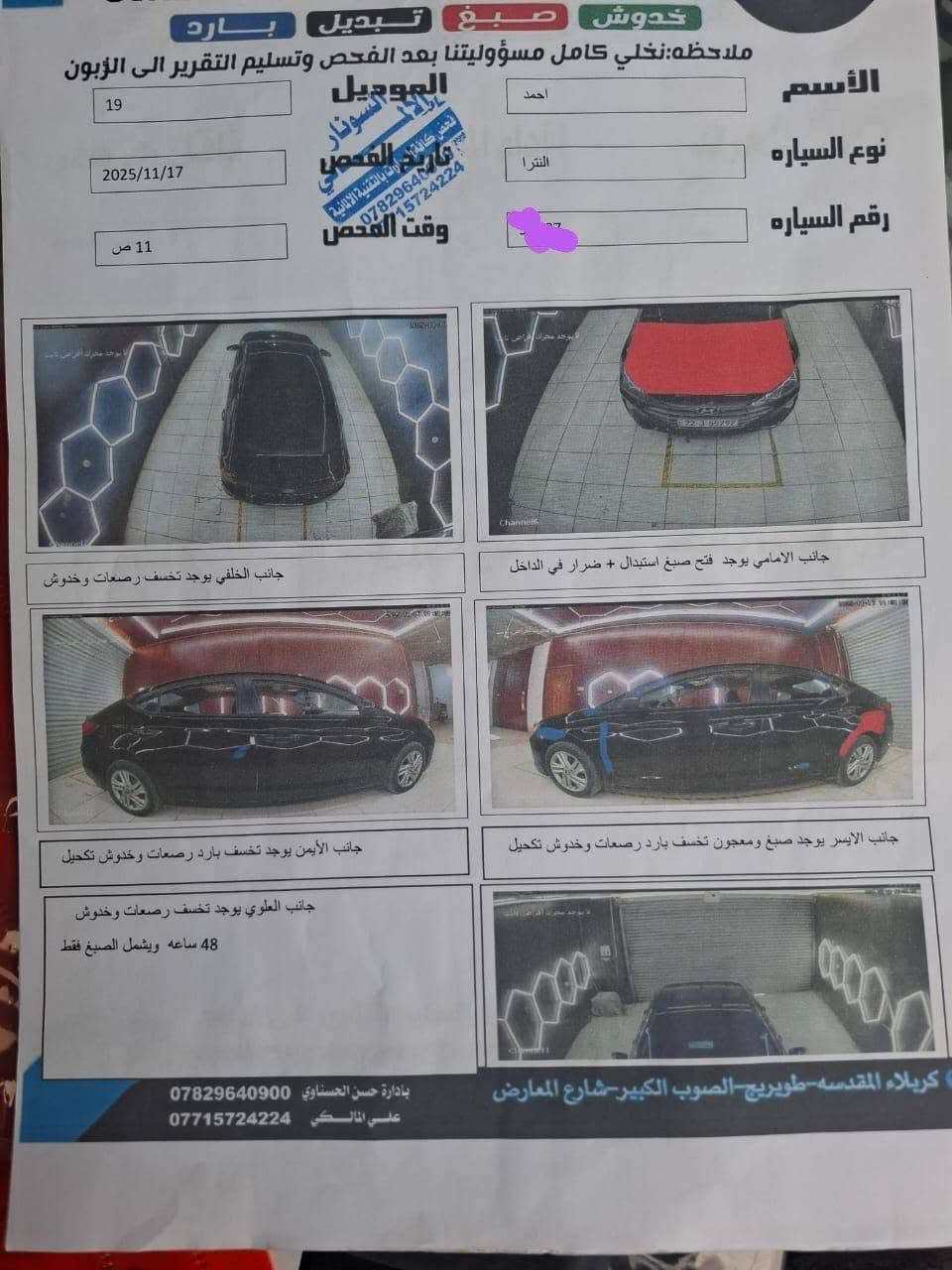 النترا موديل ١٩ وارد كندي 
كير AT بلادي 
فول مواصفات 
بصمة تشغيل 
بصمة ابواب 
بصمة صندوق 
رادار امامي جانبي 
فتحة مانع انزلاق 
مثبت سرعة 
تحديد مسار 
الحادث 👇
السونار مرفق مع الصور 
#ملاحضة_مكينة_بيها_تبخير 
رقم اربيل سنوية جديدة 
السعر ١١٨ مجال قليل 
العنوان كربلاء طويريج 
رقم الهاتف 
***********
