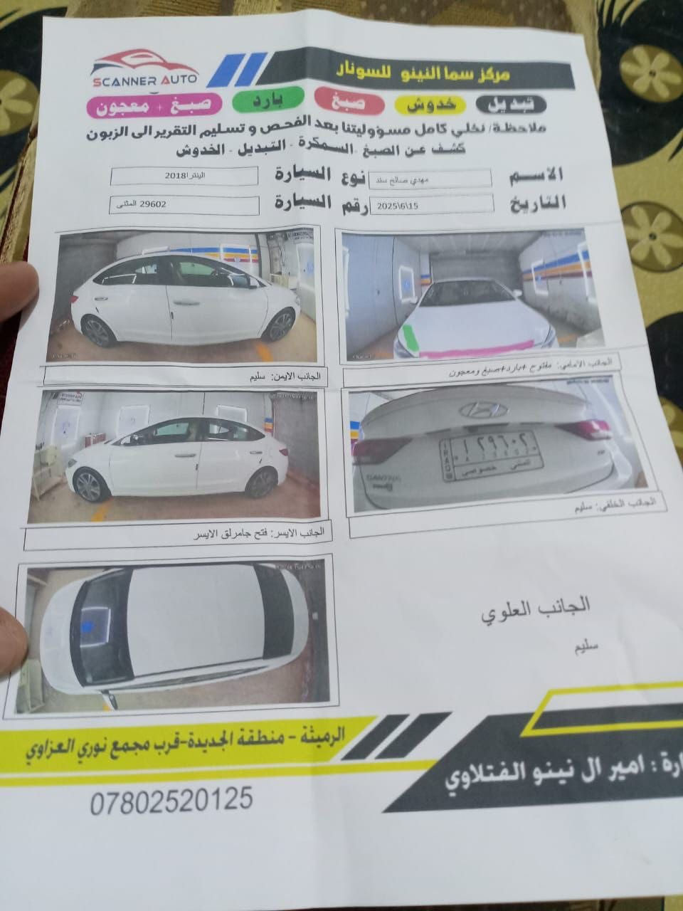 للبيع الانترا 2018 خليجي سونار موضح بالصوره
للاستفسار الاتصال على الرقم ‭٠٧٨٠ ٠٨١ ٠٩٩٣‬
