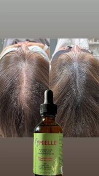 زيت إكليل الجبل • تكثيف الشعر • مييل نت