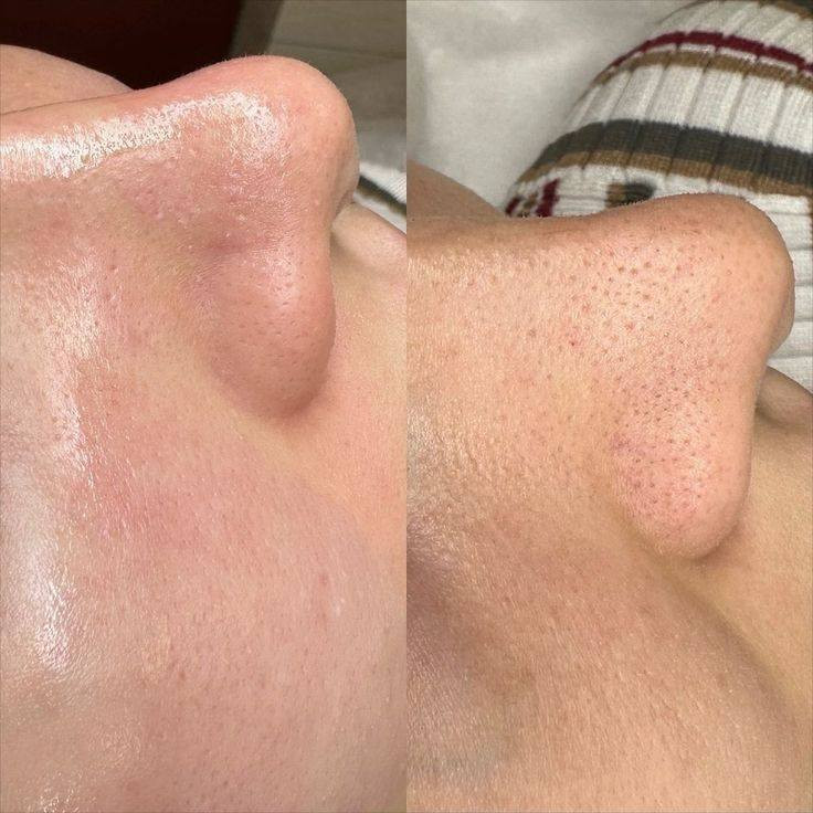 ‏🌸  اللهم صلِّ على محمد وآل محمد كما صليت على إبراهيم وآل إبراهيم 🤍
‏✨ عروض صالون الإمبراطوره – يناير 2026 ✨
‏💆‍♀️ حفافة وجه مع تنظيف بشرة عميق (هيدروفشيال)
‏💰 20,000 د.ع بدل 40,000 د.ع
‏🌸 حفافة حاجب + صبغ حاجب يدوم شهر
‏💰 6,000 د.ع
‏👑 دللي نفسچ مثل الإمبراطوره لانج تستاهلين 🤍
‏📍 العرض لفترة محدودة طوال شهر يناير
‏📞 للحجز والاستفسار: [ ‪+9647756066151‬
‏    ‪***********‬     ]
‏📍 كربلاء المقدسة، حي الحر، مقابل مجمع ليمونه 2 – صالون الامبراطوره
‏
