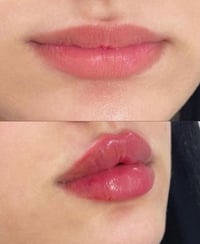 فلر • عيادة • حي سومر