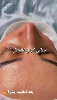 عرض كرسمس • حفافة وهايدروفشل • فلر كوري