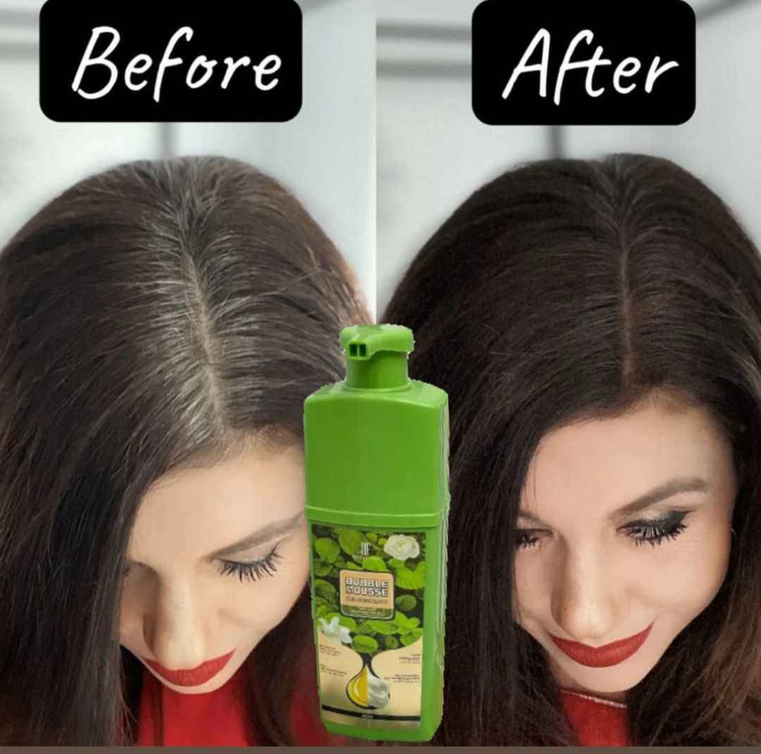 🌿✨ ودّع الشيب مع شامبو الشيب الطبي الطبيعي! ✨🌿

إذا تعبت من صبغات الأوكسجين اللي تتعب الشعر وتضر الجلد، جرب الحل الآمن والفعال مع شامبو الشيب الطبي 💆‍♀️💫

✔️ مكوناته طبيعية 100٪
مستخلصات عشبية تغذي فروة الرأس وتمنح شعرك حيوية ولمعان من أول استخدام.

✔️ خالي تماماً من الأوكسجين
ما يضعف الشعر ولا يسبب تقصف أو تساقط، آمن جداً للاستخدام المستمر.

✔️ سهل وسريع الاستخدام
بس خلال 10 دقائق ترجّع اللون الطبيعي لشعرك بدون صالونات وبدون تعب! 🕒✨

✔️ ما يطبع على الجلد نهائياً
يغطي الشعر بس بدون لا يبقع وجهك أو إيدك، الاستخدام نظيف ومرتب.

✔️ ما يسبب أي نوع من الحساسية أو الحكة
مناسب لكل الأعمار، وحتى للبشرة الحساسة 👌

🖤 استرجع ثقتك وودّع الشيب بأسلوب راقي وآمن مع شامبو طبي نباتي مضمون

#السعر_12 الف فقط

#يوجد توصيل _لجميع_المحافضات بغداد, العراق


**إذا كنت صاحب هذا الإعلان وتريد حذفه لأي سبب، رجاءا أرسل رسالة إلى الدعم الفني**