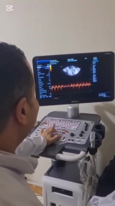 💓 بعد ٤ سنين انتظار…
أجمل صوت ممكن القلب يسمعه ❤️👶
لحظة سماع نبض الجنين لأول مرة
مش مجرد كشف أو سونار…
دي لحظة بتتعوض فيها سنين من الدعاء والصبر والأمل 🤍✨
كل رحلة تأخر حمل ليها أمل…
ومع المتابعة الصحيحة والتشخيص الدقيق ممكن الحلم يبقى حقيقة 🌸
🤰 متابعة وتأخر حمل
🩺 أحدث أجهزة السونار والفحوصات
👨‍⚕️ رعاية طبية بكل اهتمام وخصوصية
📍عيادة دكتور نسا وتوليد
📞 للحجز والاستفسار تواصلوا معنا

#نبض_الجنين #تأخر_حمل #رحلة_الأمومة #حقن_مجهري #متابعة_الحمل #دكتور_نسا_وتوليد


**إذا كنت صاحب هذا الإعلان وتريد حذفه لأي سبب، رجاءا أرسل رسالة إلى الدعم الفني**