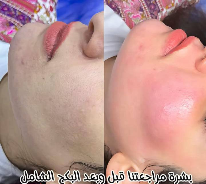 تعلن عيادات إبرو لطب الاسنان وتجميل عن عروض وتخفيضات في قسم الأسنان وتجميل مكان  العياده ماجديه نهاية شارع الجامع مقابيل مأكولات البيك ***********
