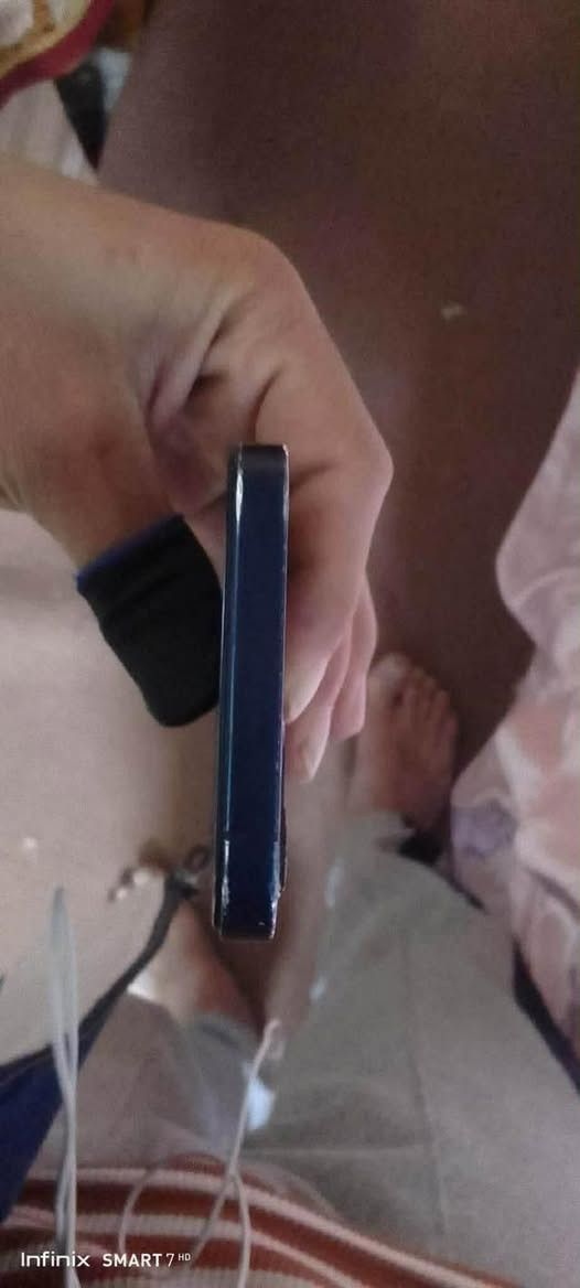 السلام عليكم 

ايفون 12 عادي  

نموذج/M 

دبل سيم 

ذاكرة 128 

بطاريه 76 بلادي شرط 

مايعبر هوه حصرر بي هاذ الفطر بالظهر وشاصي مشخط أنطيك شرط كارتونه وغراضه كامل ويا 

مراوس شعندك نزل وبيع 260 وبي مجال قليل


**إذا كنت صاحب هذا الإعلان وتريد حذفه لأي سبب، رجاءا أرسل رسالة إلى الدعم الفني**