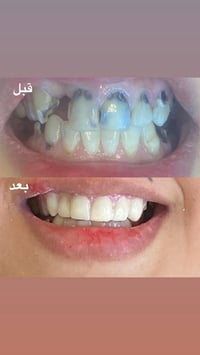 شنو الخبر الي ممكن يفرح اهالي الحسينية !؟  عيادة داليتا لطب وتجميل وتق...