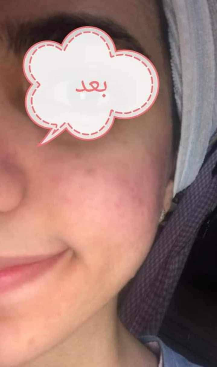 بنات لحكو ع عرض العيد🥳😍فقط للكريم الكولاجين صار التوصيل مجاني بكل محافضات العراق والسعر ١٥ فقط 
يخلص العرض اول يوم العيد 🥳😍 لا يفوتكم العرض يخبل والكريييم احله اكيد 🫶🪬♥️♥️


**إذا كنت صاحب هذا الإعلان وتريد حذفه لأي سبب، رجاءا أرسل رسالة إلى الدعم الفني**