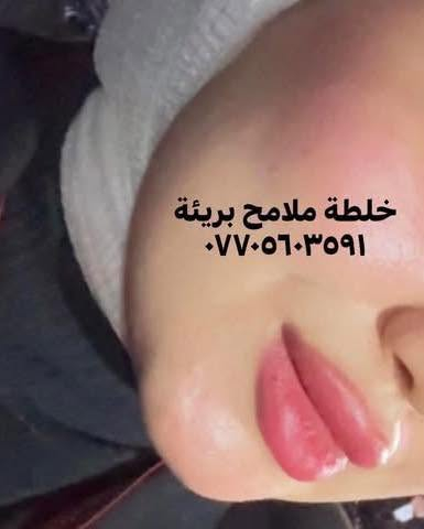 عروض عيد الاضحى المبارك 🔥
خلطة ملامح بريئة ١٠ الف 
مع صابونة هدية 
توصيل 2 داخل الكوت 
خارج الكوت ٥
تنتهي العروض ٢٠٢٦/٥/٢٥
#اكسبلور_explored


**إذا كنت صاحب هذا الإعلان وتريد حذفه لأي سبب، رجاءا أرسل رسالة إلى الدعم الفني**