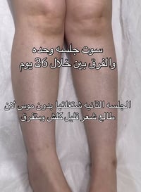 جلسة اولى • نتائج تخبل • العبيذي شارع الاطباء