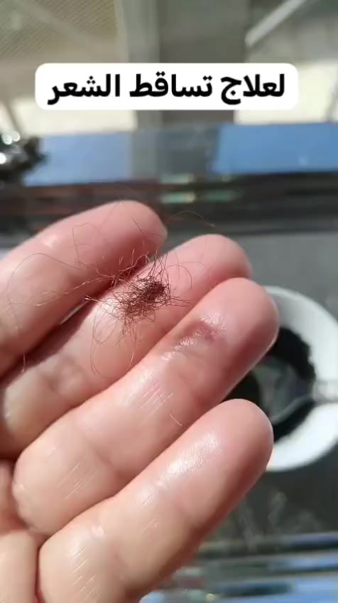 طحالب السبايرولينا  لعلاج تساقط الشعر
منجم فيتامينات ومعادن وبروتينات احسن تغذيه للشعره


**إذا كنت صاحب هذا الإعلان وتريد حذفه لأي سبب، رجاءا أرسل رسالة إلى الدعم الفني**