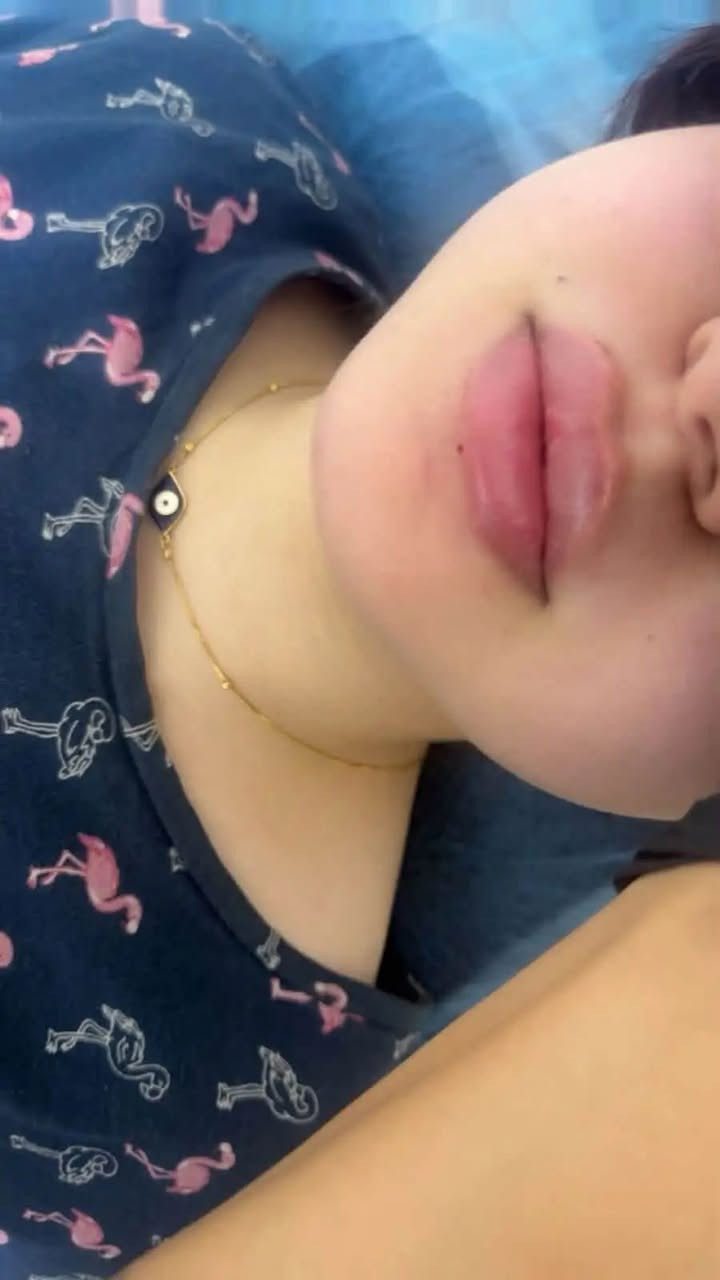 حقن فلر الشفاه👄 بطريقة ناعمة لمراجعتي الجميلة 
 
الهدف من الحقن💉إبراز الجمال الطبيعي وليس تغييره ❤️‍🔥

ميرو للَتجْميل واللَيزَرْ 
للحجز والاستفسار :***********
@إشارة
