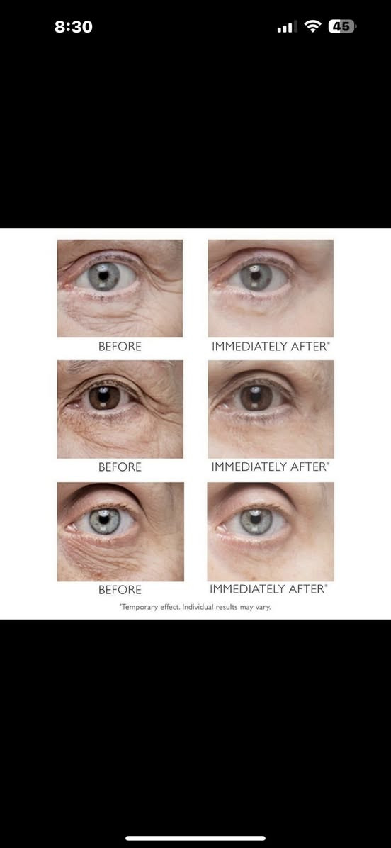 ✨ وصل كريم بيتر توماس روث المعجزة الامريكية لشد البشرة Peter Thomas Roth Instant FirmX Eye هو الحل السريع والفعّال لشدّ منطقة تحت العين والتخلّص من مظهر التعب، التجاعيد، والخطوط الدقيقة خلال دقائق!

هذا المنتج المصمّم بتقنية متطورة يشتغل فورًا على شدّ البشرة وتنعيمها، ويقلّل من مظهر الانتفاخ والهالات، ويخلي منطقة العين تبين أصغر سنًا، أنعم، وأكثر إشراقًا. أول ما تحطّيه، تحسّين بتأثير الشدّ الفوري، وتلاحظين فرق واضح بالملمس والشكل 😍

✨ مميزات المنتج:
شدّ فوري ومؤقّت لمنطقة تحت العين
يقلّل من مظهر التجاعيد والخطوط الدقيقة
يخفف الانتفاخ والهالات
يخلي البشرة ناعمة ومشدودة
مناسب لكل أنواع البشرة
مثالي قبل المكياج أو المناسبات


**إذا كنت صاحب هذا الإعلان وتريد حذفه لأي سبب، رجاءا أرسل رسالة إلى الدعم الفني**