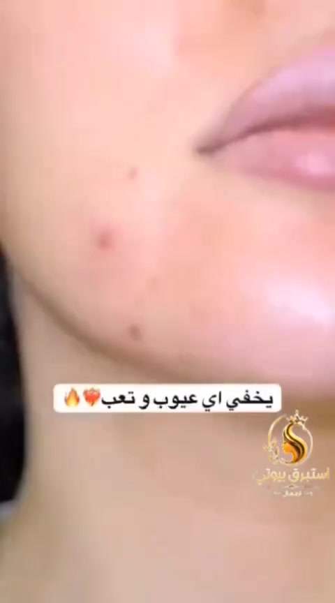 توقفـي لحظة! ✋
إذا بشرتج تعاني من: حبوب... مسام واسعة... رؤوس سوداء... وفقدان النضارة...
فهذا الفيديو إلج. 
مع كريم GND والعناية اليومية الصحيحة، تساعدين بشرتج على الظهور بشكل أنعم، أنظف، وأكثر إشراقًا.
لا تخلي مشاكل البشرة تسرق ثقتج... ابدئي العناية من اليوم، وشوفي الفرق مع الاستمرار. 
راسلينا الآن واحجزي عرضج قبل لا ينتهي


**إذا كنت صاحب هذا الإعلان وتريد حذفه لأي سبب، رجاءا أرسل رسالة إلى الدعم الفني**