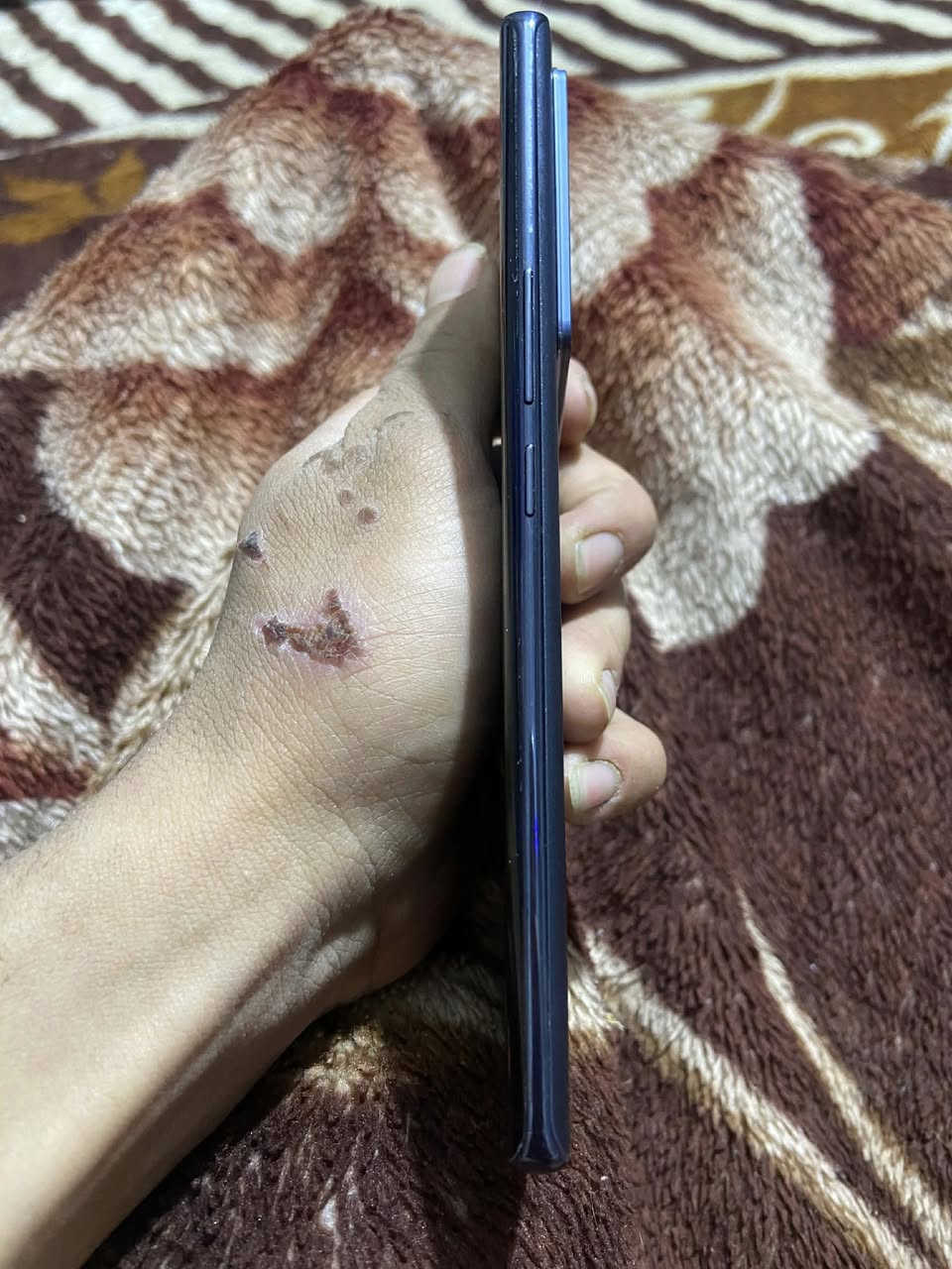 انفنكس نوت40برو بلس5G ذاكرة256 رام12 شاشه120هرتز جهاز مكفول زلغ مابي بصمه وجه معالج معروف مالته 🩵 بدون غراض جهاز مكفول زلغ مابي كله شغال نضافه90 مراوس فقط حسب الرغبة مكاني بغداد الحريه


**إذا كنت صاحب هذا الإعلان وتريد حذفه لأي سبب، رجاءا أرسل رسالة إلى الدعم الفني**