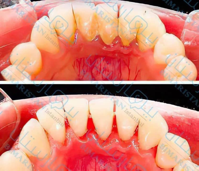 سلام عليكم منو محتاج تنظيف اسنان من تكلسات التصبغات 
هذا اخر شهر مجاني 
عنوان جامعة فراهيدي 
وايضاً يوجد حشوات تجميلية بيضة
مراسلة ع رقم 
***********
