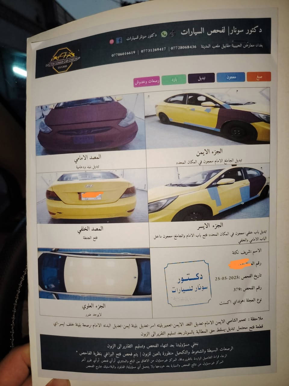 اكسن مديل 2014 امضلع محرك كير عل فحص قطعتين تبديل وبيها بين البابين من جهت السايق معجول مال طخه كابون بانزين بيها مكان الشمسيات او بل موصل هم اتواجد سعر 87وبيها مجال رقم ***********
