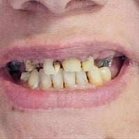 مراجعة تركيب • بغير عيادة • المسيب شارع البلدية