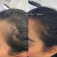 صابونة سيفن جرين • شامبو صلب • بدون كبريتات