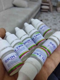 شامات • زوائد جلدية • أربيل