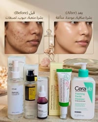 بشرة دهنية • علاج الحبوب • CeraVe