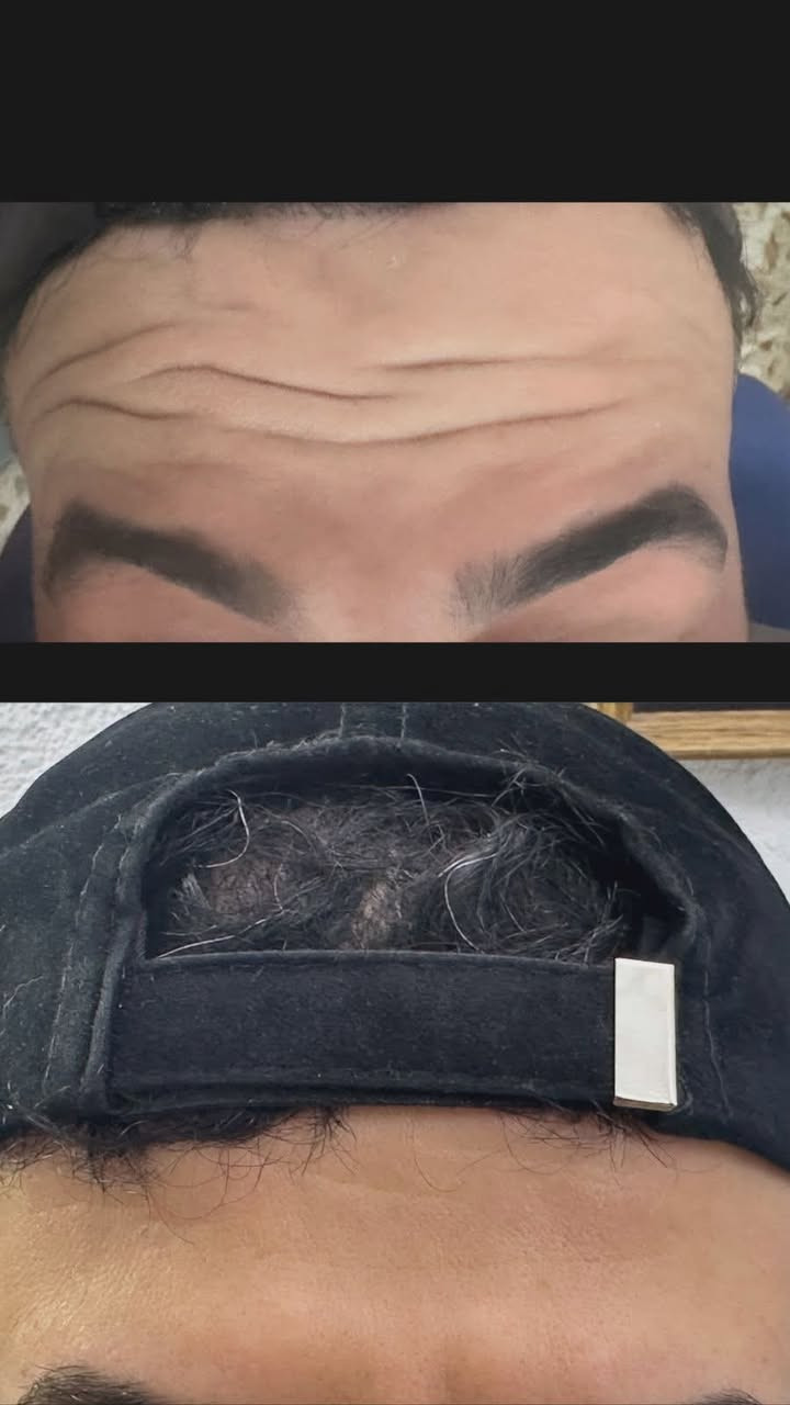 تجميل الاجراحي مع الدكتورات من عياده دكتور محمد فتين الدريعي  
د. عفراء محسن ناصر شنيع🦷👑
د. فاطمة محمد عارية 🦷👑
رقم الحجز&0772043200🍓


**إذا كنت صاحب هذا الإعلان وتريد حذفه لأي سبب، رجاءا أرسل رسالة إلى الدعم الفني**