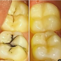 عيادة الابتسامة • تنظيف اسنان • حشوات وقلع