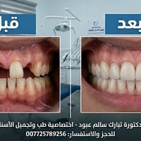 ضمان مفتوح • بسماية • قرب الباشا