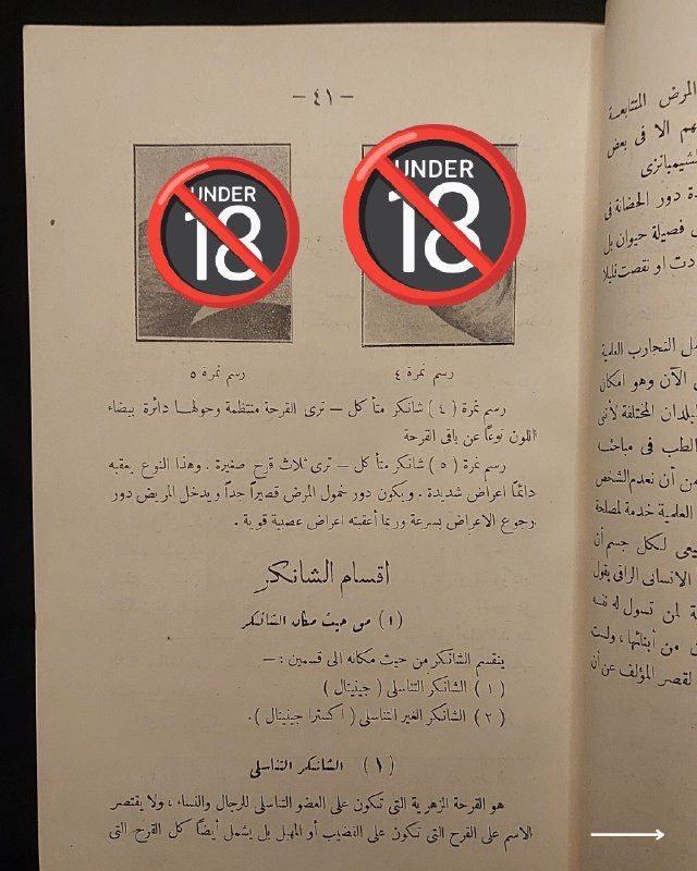 "مرجع طبي تراثي نادر في علم الأمراض السريرية والعلاجات الكلاسيكية!"
🌍
📜
🩺
🩸
📘
(كتاب الأمراض التناسلية وعلاجها وطرق الوقاية منها)
تأليف: الدكتور فخري (طبيب الجلد والأمراض التناسلية).
⚜️
📚
ناشر الطبعة: المطبعة العصرية ومكتبة الخليل لصاحبها خليل الخليلي - مصر
🇪🇬
.
✨
عن هذه النسخة التراثية:
سنة الطبع: 1960-1970
الحالة: ممتازة
✅
الموضوع:
كتاب طبي تاريخي وتخصصي رصين يستعرض بدقة علمية كلاسيكية منظومة الأمراض التناسلية والجلدية الشائعة وطرق تشخيصها السريري وعلاجاتها الدوائية والوقائية المعتمدة في القرن الماضي، يهم جداً أطباء الجلدية والتناسلية، طلاب كليات الطب والصيدلة، الباحثين في تاريخ العلوم الطبية، وهواة اقتناء المخطوطات والمراجع الطبية التراثية النادرة.
للحجز
🔻
:
البوت:
@PH_900bot
أو واتساب: ***********
