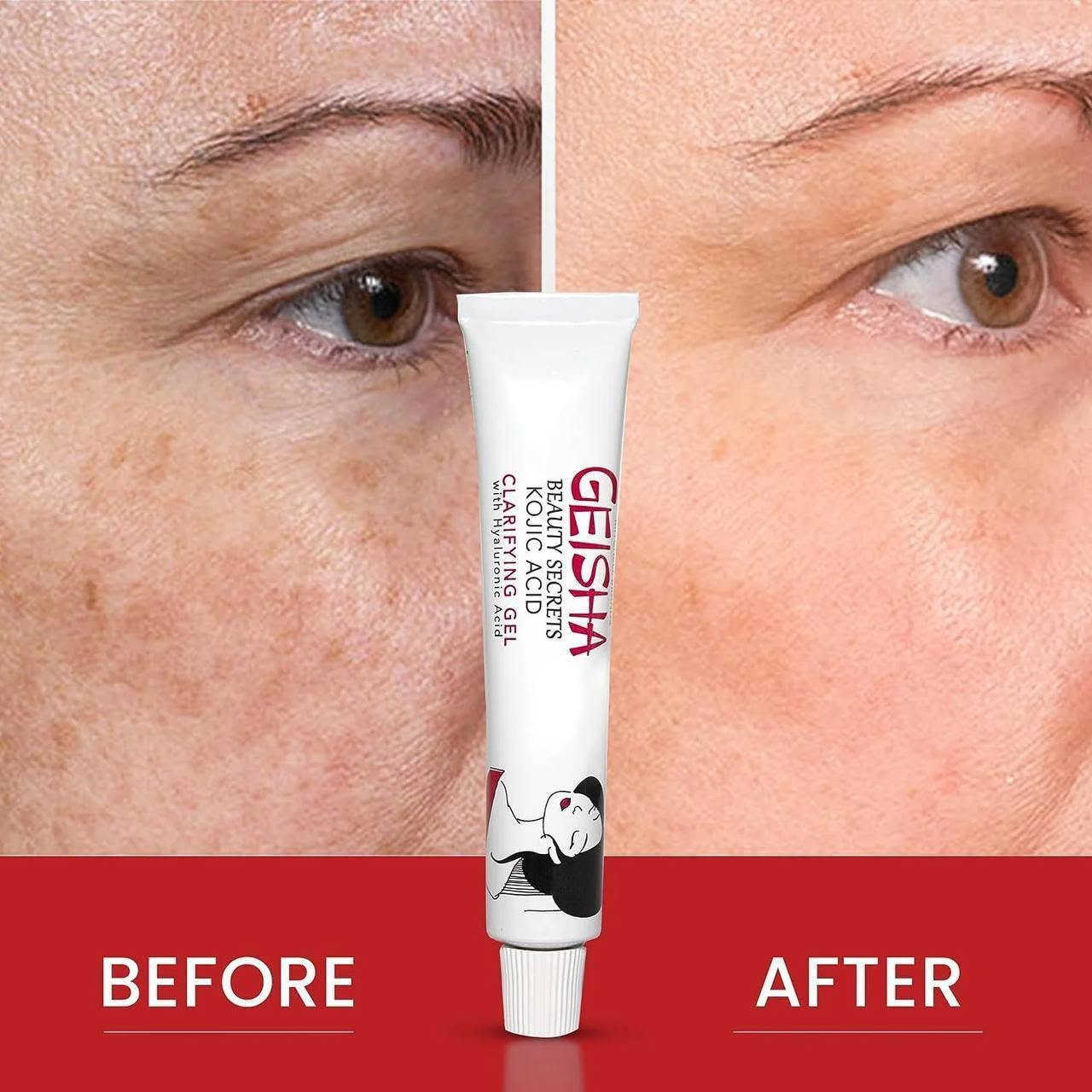 ✨ عصارة غيشا من كوجي ✨
GEISHA BEAUTY SECRETS KOJIC ACID BRIGHTENING 
CREAM

🌟 كريم غيشا العالمي 🌟
🔑 سر من أسرار الجمال بـ حمض الكوجيك 🔑
💖 فوائد المنتج:
 ⚡ أقوى كريم لتفتيح البشرة: يحتوي على حمض الكوجيك المعروف بقدرته العالية على تقليل التصبغات والبقع الداكنة.
 🎯 توحيد لون البشرة: يساعد في تحسين مظهر البشرة غير المتجانسة ومنحها مظهراً متناغماً.
 ☀️ مكافحة الكلف والنمش: يقلل من ظهور الكلف والنمش الناتج عن أشعة الشمس أو التغيرات الهرمونية.
 🌱 تفتيح آثار حب الشباب: يساهم بشكل فعال في تفتيح البقع الداكنة الناتجة عن الحبوب السابقة.
 💧 ترطيب خفيف: يحتوي عادةً على مكونات مرطبة بجانب حمض الكوجيك لتحسين نعومة البشرة ومرونتها.
المنشأ لبنان الأصلية 🇱🇧


**إذا كنت صاحب هذا الإعلان وتريد حذفه لأي سبب، رجاءا أرسل رسالة إلى الدعم الفني**
