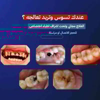 علاج مجاني • جامعة العين • استشارة خاصة