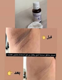 سيروم فرنسي أصلي • مناطق حساسة • تفتيح تصبغات