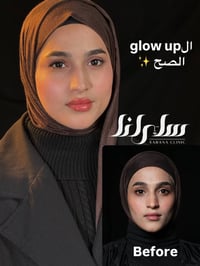 ال glow up الحقيقي  أقوى عروضنا للتغيير الشامل تلكوها بآخر صوره  ساران...