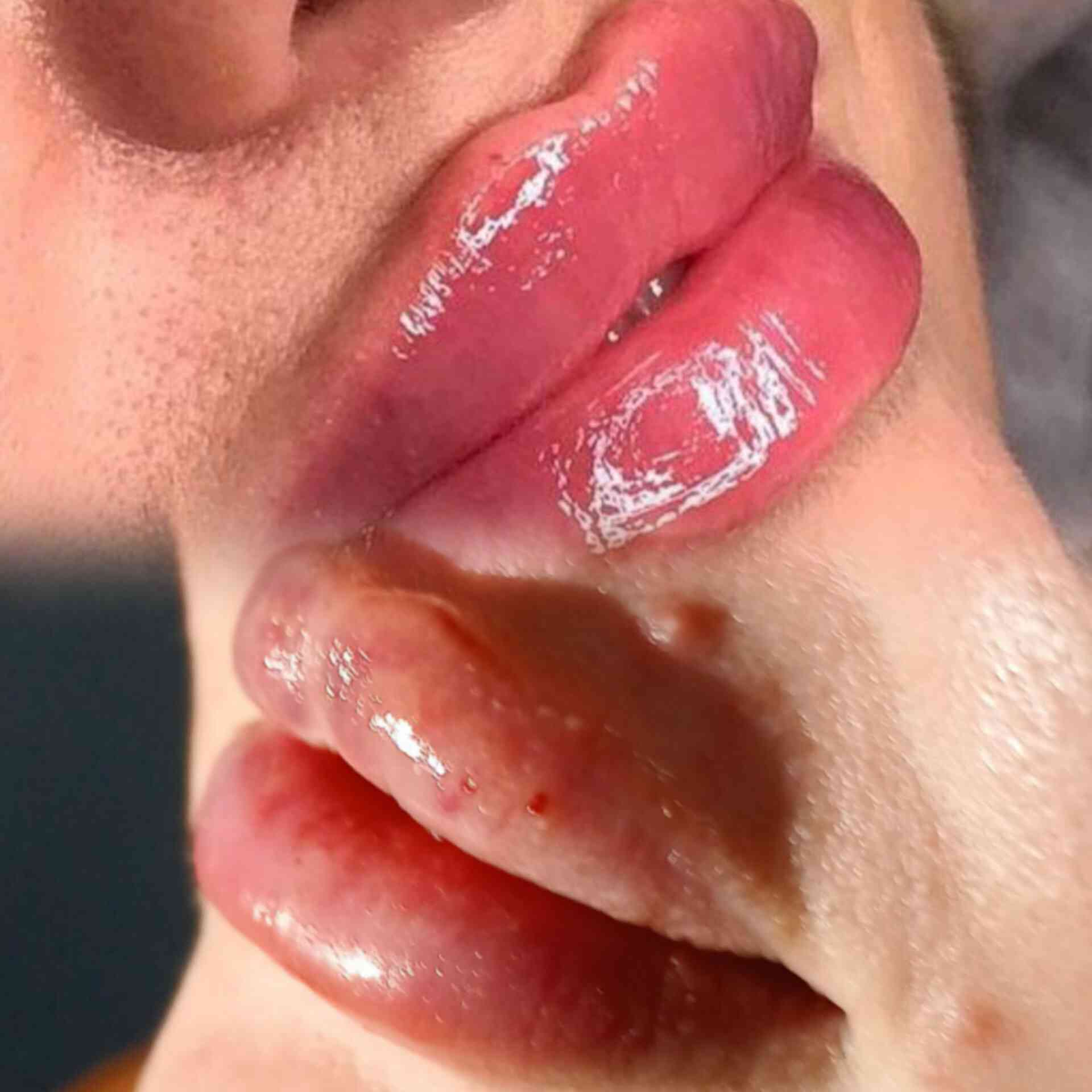 عروض العيد المبارك للتجميل لفترة محدودة 
1- تغيير شامل بالفلر الكوري يشمل (اصداغ + وجنات + استدارة +شفة +ذقن + تكساس ) 
تغيير 6 ابر فلر + ابرة نظارة 225 الف 
تغيير 8 ابر فلر + ابرة بلازما مفعلة 300الف 
تغيير 10ابر فلر + ابرة الكولاجين 350 الف 
العرض الثاني تنظيف بشرة + نظارة 40 الف 
تنظيف بشرة بجهاز التقشير الماسي + ابرة بلازما 25 الف
بوتوكس رفع جبين وحاجب 85الف 
فلر شفة 50الف 
 خيوط الشد كل خيط 50الف فقط 
ازالة الكلف والتصبغات حسب المنطقة 
فلر وجنات 50الف 

بغداد / الدورة/ شرطة ابو طيارة 
مقابل مكتب صلاح الدين  للعقارات 
***********
