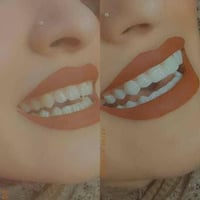 طقم اسنان • سنابون سمايل • سيليكون