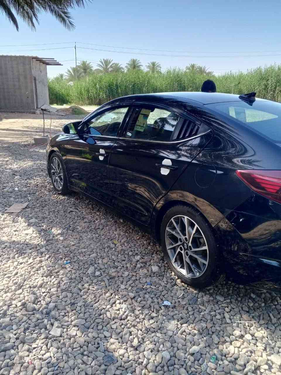 ياالله النترا موديل ٢٠ وارد بصمة تشغيل 3انضمة قيادة مثبت سرعة حساس بريك شاشة بيها ٢قطع فقط بدون دواخل 
المحروسة ماشية٦٣حقيقي بالحقيقة احلى من الصور 
السعر 130$بيها مجال بسيط كلش 
الاستفسار على هذا الرقم ***********
