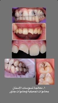 عيادة اسنان • علاج مجاني • تقويم اطفال