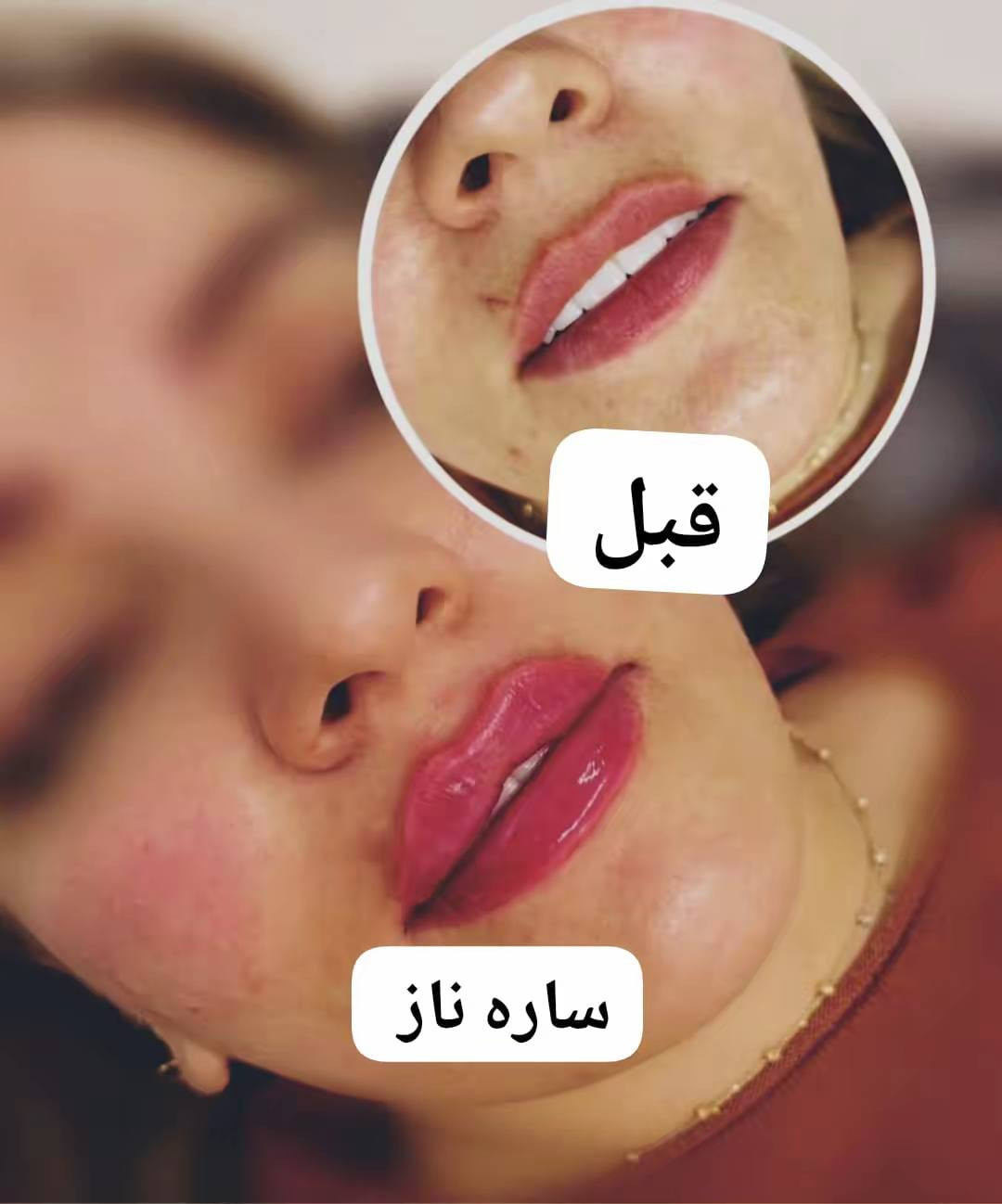 السلام عليكم  حبايب عروض،شهر رمضان الكريم  فلر السويسري لشفه  40 الف  والكوري 35 الف   والفرنسي  60 الف. 💋💋تغيير شامل بلكوري 175 الف. تغيير شامل بلسويسري 225 الف. تغير شامل بلفرنسي 300 الف . الشامل يشمل وجنات خدود ذقن اصداغ شفه sواحد 
 مكان بغداد الجديده نعيريه قرب فلكه رقم عشره


**إذا كنت صاحب هذا الإعلان وتريد حذفه لأي سبب، رجاءا أرسل رسالة إلى الدعم الفني**