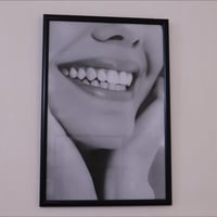 مسابقة العيد • تقويم أسنان • تبييض وحشوات