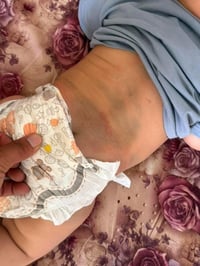 فتحة بالقلب • تبرعات • مراجعة بعقوبة