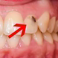 حشوات الجذور • مجانية • جامعة كربلاء