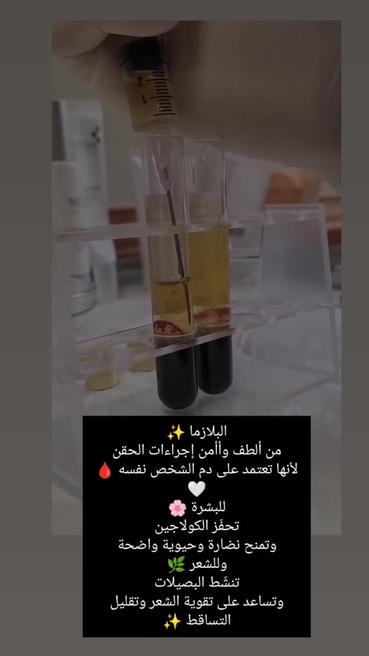 #مو كل علاج يحتاج مواد كثيرة…
أحياناً الحل بجسمك إنتِ ✨
البلازما تعزز نضارة البشرة
وتحفّز نمو الشعر وتقوّي البصيلات 🤍
نتائج طبيعية، آمنة، ولمعة تبين فرقها ويا الوقت 🌱


**إذا كنت صاحب هذا الإعلان وتريد حذفه لأي سبب، رجاءا أرسل رسالة إلى الدعم الفني**
