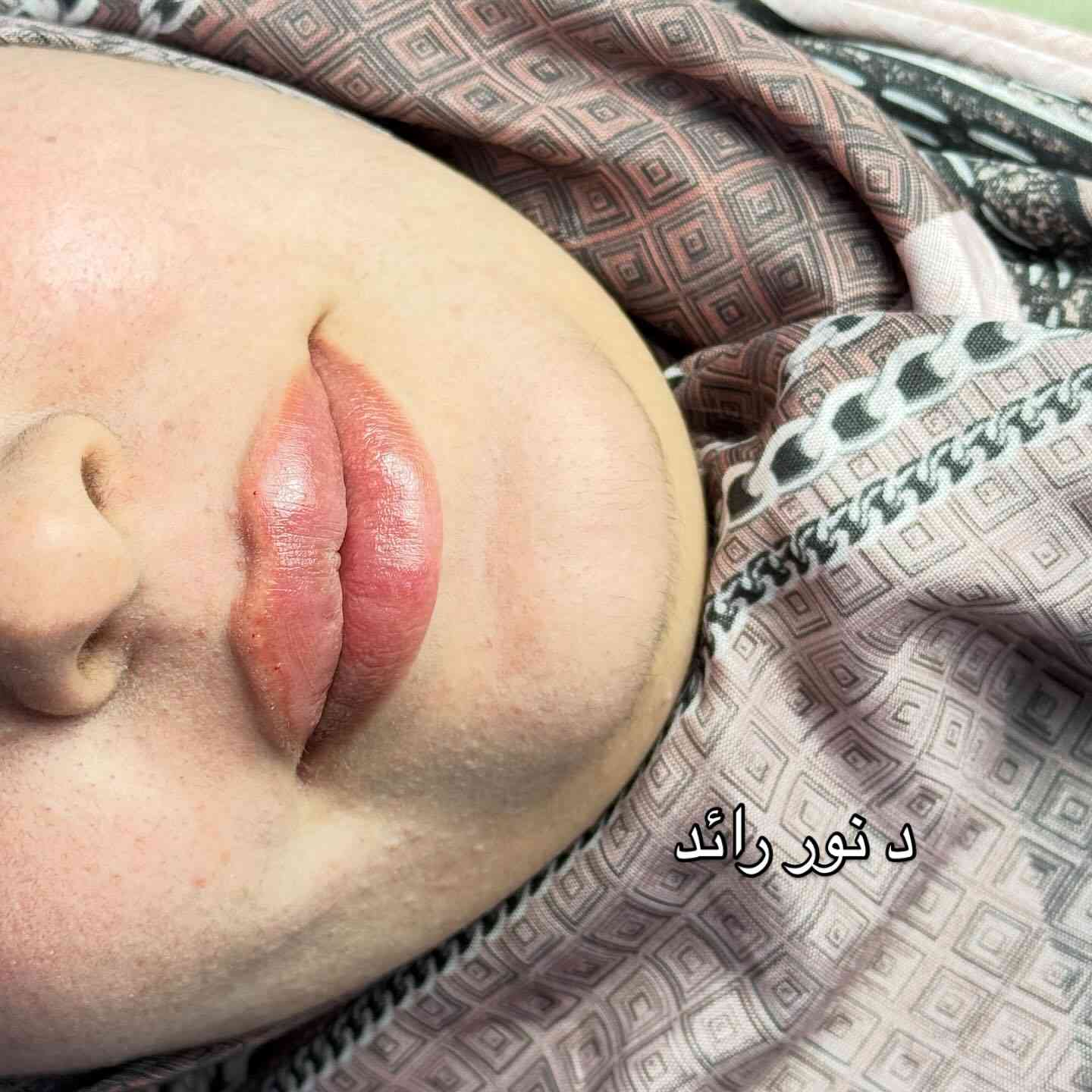 رسمة شفة مرسومة بدقة بأيد الدكتورة نور رائد @dr.noor_almafraji 
#اكسبلورر #فولو #اكسبلورexplore #اكسبلور_explore #فورتنايت


**إذا كنت صاحب هذا الإعلان وتريد حذفه لأي سبب، رجاءا أرسل رسالة إلى الدعم الفني**