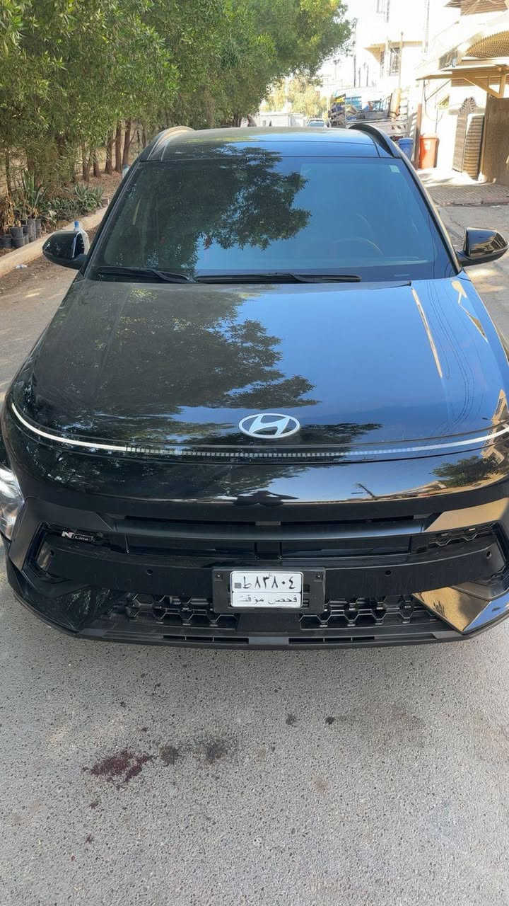 السلام عليكم كونا موديل 24 فول الفول N لاين منفيست باسمي تحويل ثاني يوم ماشيه 9 الاف حادثه موضح بالصور جاملغ امامي وباب فقط بدون دواخل ولا ايرباك مواصفات بصمه بنراما تشغيل عن بعد رادارات امامي خلفي ويل كب رياضي كتات رياضي كشنات ختم N كراسي كهرباء شاحن واير ليس شفتات ستيرن هند بريك بصمه كير تعليك لمس كشنات تدفه تبريد وباقي مواصفات N لاين معروفه مكان سياره بغداد السعر ١٦٥ بيه مجال بسيط الإتصال على الرقم ***********
