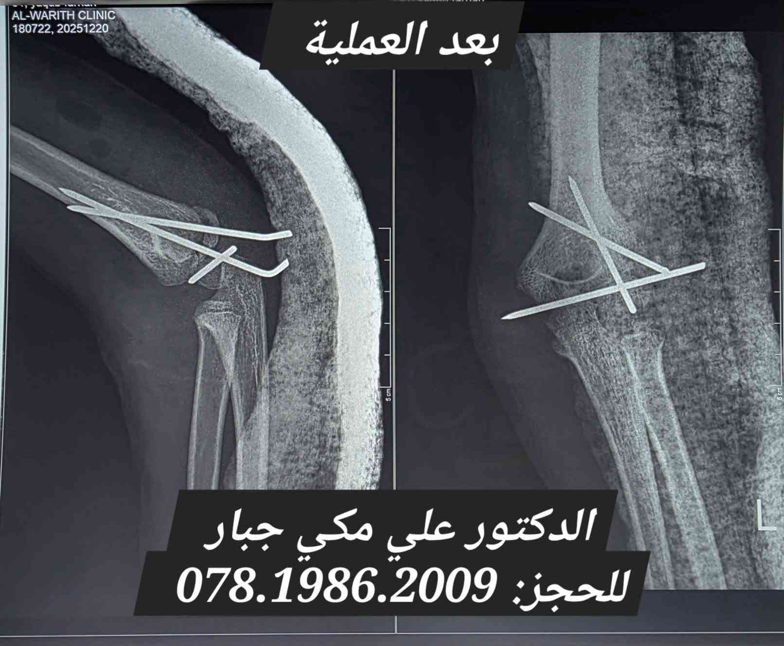 الدكتور علي مكي جبار
