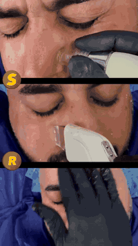 الشعور بالانتعاش والتجديد مع جلسة هايدروفيشل   💦  

✔ تنظيف بشرتك بعمق 
✔ تقشير البشرة 
✔ يقوم بترطيب بشرتك 
✔ يساعد في علاج من الأمراض الجلدية 
✔ معالجة الدهون الزائدة
✔ إزالة خلايا الجلد الميت 
✔ البثور والجفاف 
.
✨
✔️تفتيح لون البشرة و اعادة صفاءها 
✔️يزيل خلايا الجلد الميتة، والرؤوس السوداء. 
 
✔️يمنع تراكم إفراز الغدد الدهنية في المسام 
✔️ويقلل من إنتاج الزيوت. 
✔️يوحد لون البشرة و إعادة النضارة للبشرة. 
✔️يعمل على تضييق مسامات الوجه الواسعة. 
.
.
.
📞***********
العنوان :بابل شارع 40

.
.
.
#تنظيف_بشرة
#هايدروفيشل
#سنتر_سيزر_للعناية_بالشعر_والبشرة
